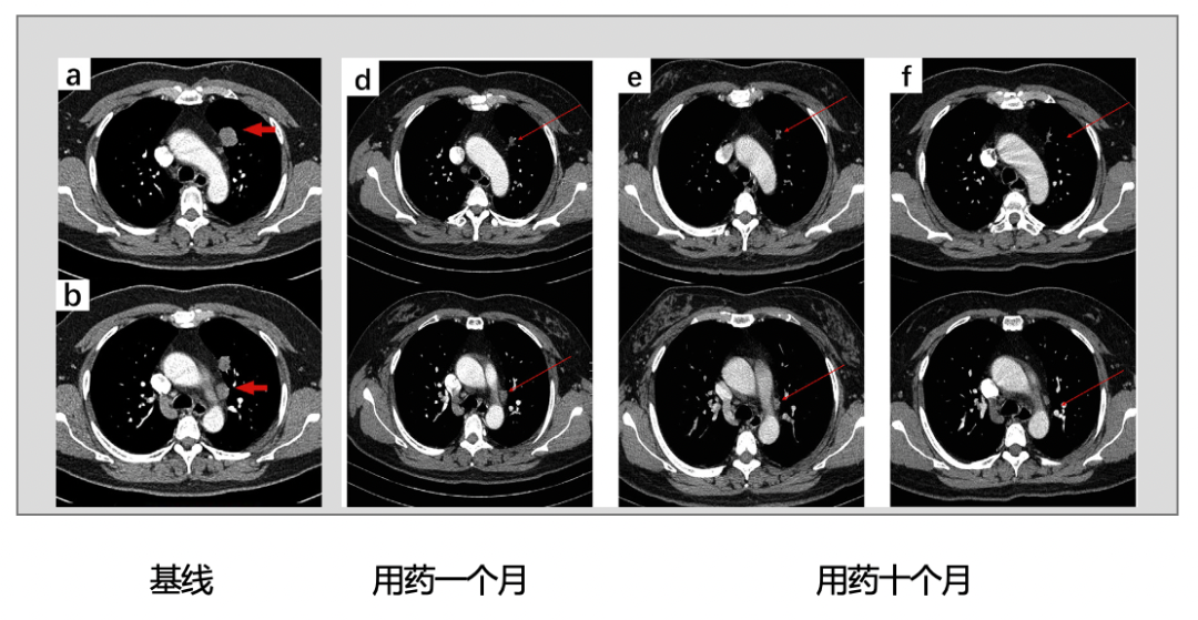 1657500263669961.png 微信图片_20220711084111.png