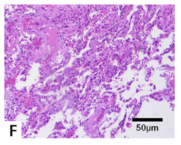 1657500293555841.png 微信图片_20220711084150.png